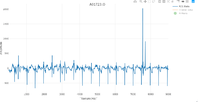 Figure 4 for Atrial Fibrillation Detection Using RR-Intervals for Application in Photoplethysmographs