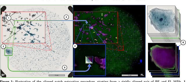 Figure 1 for Let it shine: Autofluorescence of Papanicolaou-stain improves AI-based cytological oral cancer detection