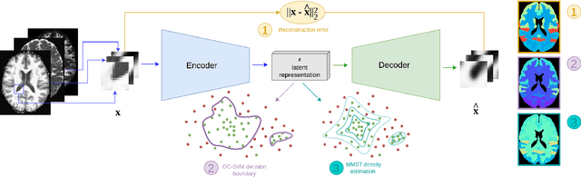 Figure 1 for Brain subtle anomaly detection based on auto-encoders latent space analysis : application to de novo parkinson patients