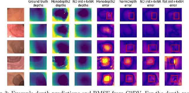 Figure 4 for A Surface-normal Based Neural Framework for Colonoscopy Reconstruction