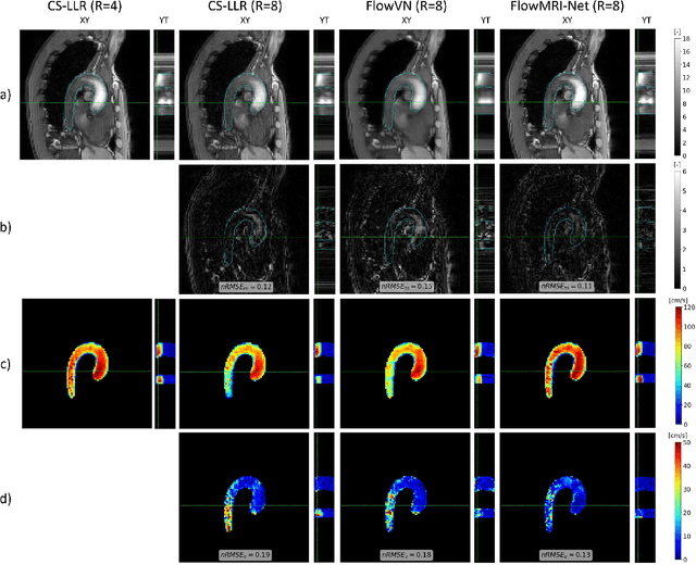 Figure 2 for FlowMRI-Net: A generalizable self-supervised physics-driven 4D Flow MRI reconstruction network for aortic and cerebrovascular applications