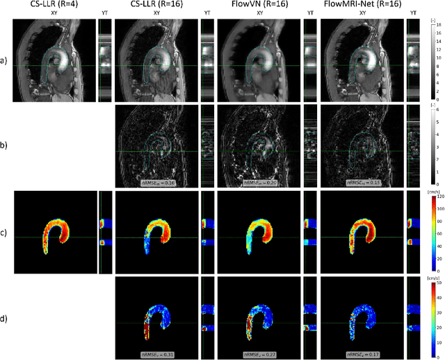 Figure 3 for FlowMRI-Net: A generalizable self-supervised physics-driven 4D Flow MRI reconstruction network for aortic and cerebrovascular applications