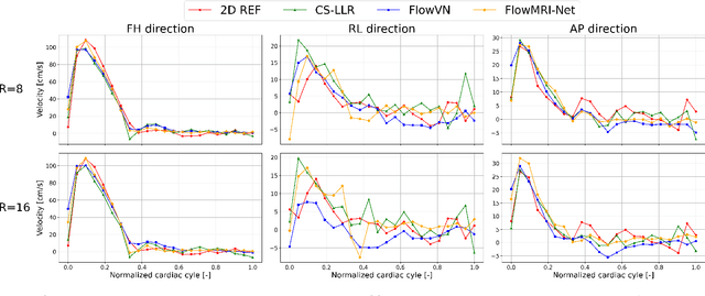 Figure 4 for FlowMRI-Net: A generalizable self-supervised physics-driven 4D Flow MRI reconstruction network for aortic and cerebrovascular applications