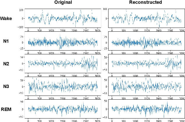 Figure 2 for Multi-Signal Reconstruction Using Masked Autoencoder From EEG During Polysomnography