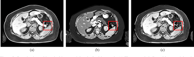 Figure 3 for SVRDA: A Web-based Dataset Annotation Tool for Slice-to-Volume Registration