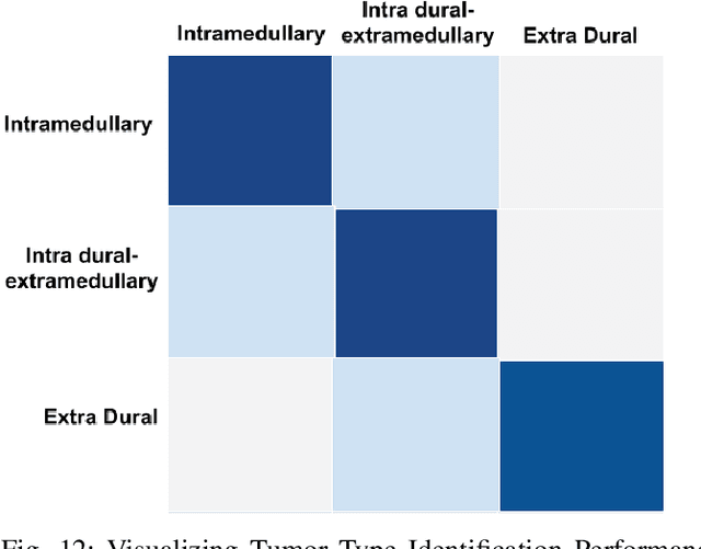 Figure 4 for Lumbar Spine Tumor Segmentation and Localization in T2 MRI Images Using AI