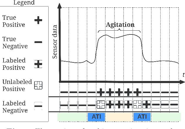 Figure 2 for Undersampling and Cumulative Class Re-decision Methods to Improve Detection of Agitation in People with Dementia