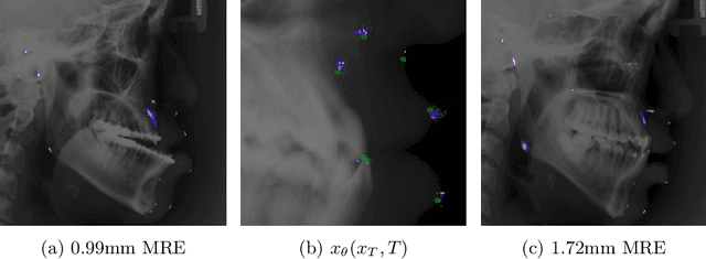 Figure 4 for Salt & Pepper Heatmaps: Diffusion-informed Landmark Detection Strategy