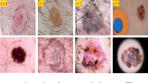 Figure 1 for Generative Adversarial Networks based Skin Lesion Segmentation