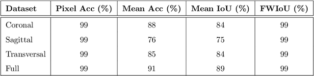 Figure 4 for Using U-Net Network for Efficient Brain Tumor Segmentation in MRI Images