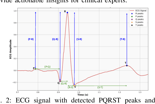 Figure 2 for ECG Unveiled: Analysis of Client Re-identification Risks in Real-World ECG Datasets