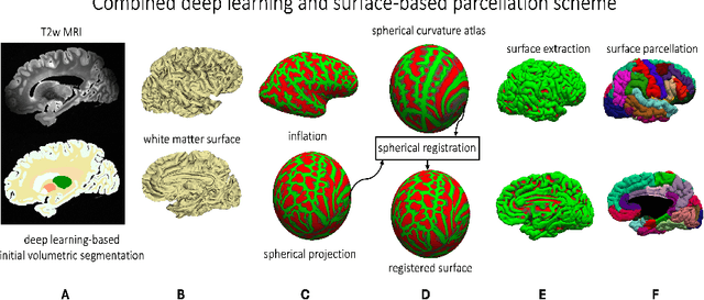 Figure 1 for Surface-based parcellation and vertex-wise analysis of ultra high-resolution ex vivo 7 tesla MRI in neurodegenerative diseases