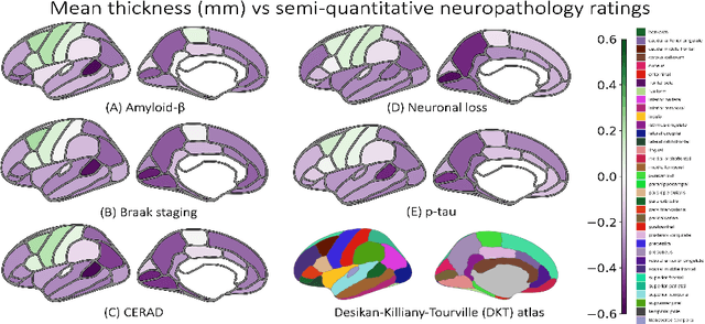 Figure 3 for Surface-based parcellation and vertex-wise analysis of ultra high-resolution ex vivo 7 tesla MRI in neurodegenerative diseases