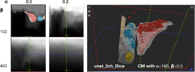 Figure 4 for Can ultrasound confidence maps predict sonographers' labeling variability?