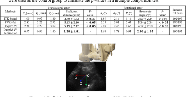 Figure 1 for Deep Regression 2D-3D Ultrasound Registration for Liver Motion Correction in Focal Tumor Thermal Ablation