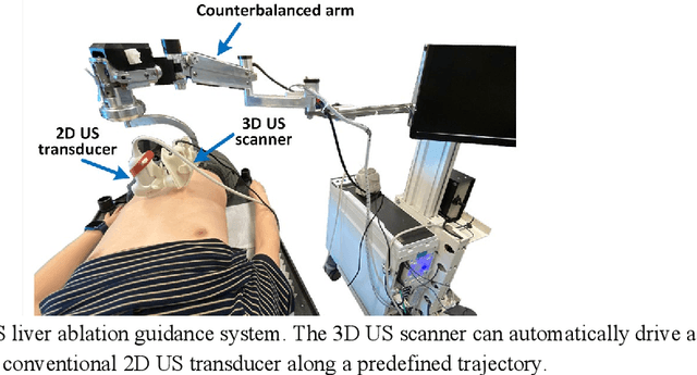 Figure 2 for Deep Regression 2D-3D Ultrasound Registration for Liver Motion Correction in Focal Tumor Thermal Ablation