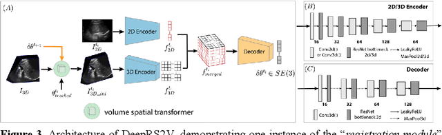 Figure 4 for Deep Regression 2D-3D Ultrasound Registration for Liver Motion Correction in Focal Tumor Thermal Ablation