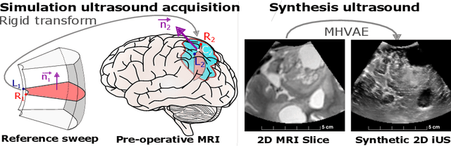 Figure 3 for Patient-Specific Real-Time Segmentation in Trackerless Brain Ultrasound