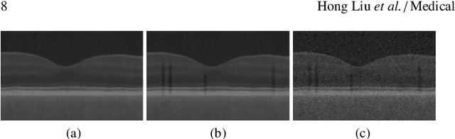 Figure 2 for Simultaneous Alignment and Surface Regression Using Hybrid 2D-3D Networks for 3D Coherent Layer Segmentation of Retinal OCT Images with Full and Sparse Annotations