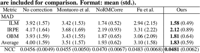 Figure 3 for Simultaneous Alignment and Surface Regression Using Hybrid 2D-3D Networks for 3D Coherent Layer Segmentation of Retinal OCT Images with Full and Sparse Annotations