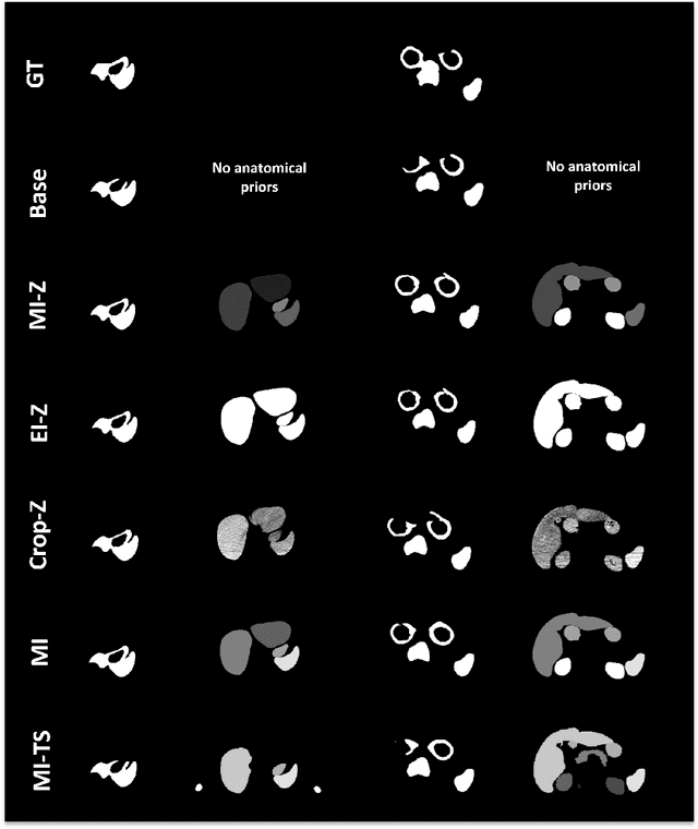 Figure 2 for Investigating Gender Bias in Lymph-node Segmentation with Anatomical Priors