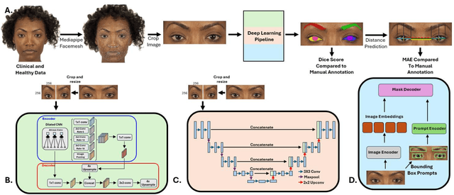 Figure 3 for State-of-the-Art Periorbital Distance Prediction and Disease Classification Using Periorbital Features