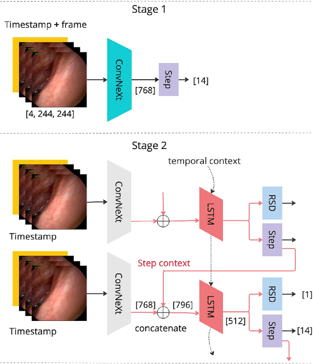 Figure 2 for PitRSDNet: Predicting Intra-operative Remaining Surgery Duration in Endoscopic Pituitary Surgery