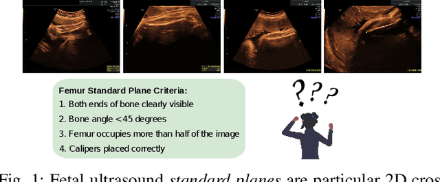 Figure 1 for Learning semantic image quality for fetal ultrasound from noisy ranking annotation