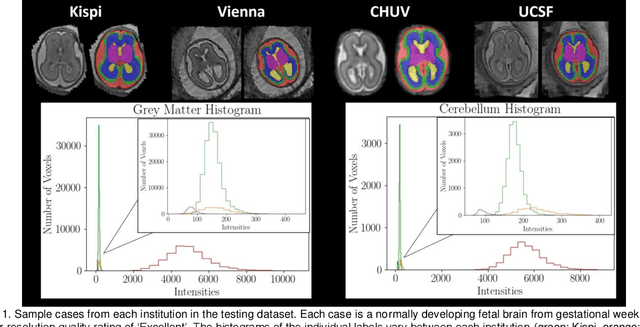 Figure 1 for Multi-Center Fetal Brain Tissue Annotation (FeTA) Challenge 2022 Results