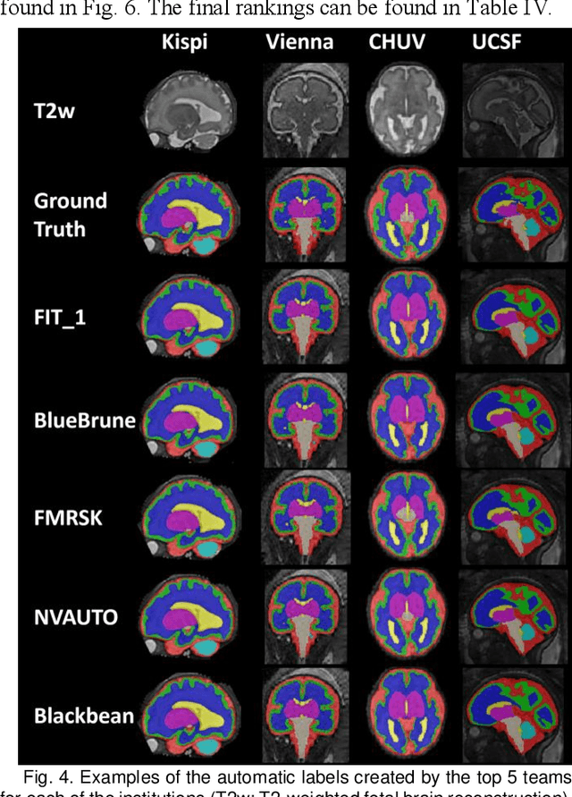 Figure 4 for Multi-Center Fetal Brain Tissue Annotation (FeTA) Challenge 2022 Results