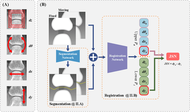 Figure 2 for A Deep Registration Method for Accurate Quantification of Joint Space Narrowing Progression in Rheumatoid Arthritis