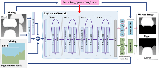 Figure 4 for A Deep Registration Method for Accurate Quantification of Joint Space Narrowing Progression in Rheumatoid Arthritis