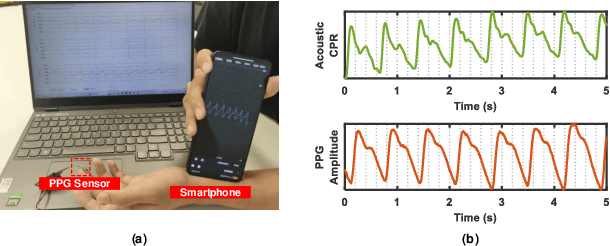 Figure 1 for AcousAF: Acoustic Sensing-Based Atrial Fibrillation Detection System for Mobile Phones