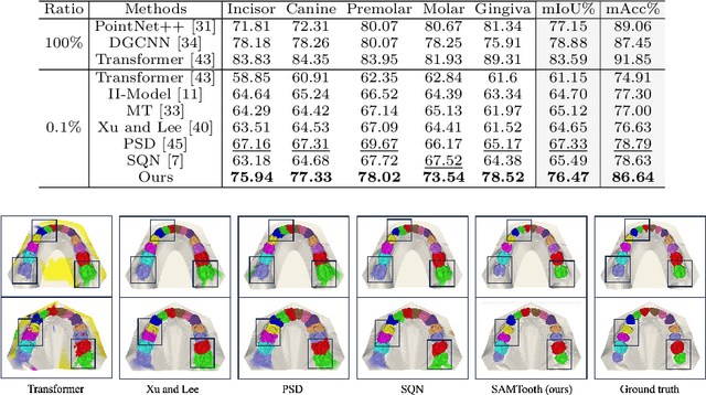 Figure 2 for When 3D Partial Points Meets SAM: Tooth Point Cloud Segmentation with Sparse Labels