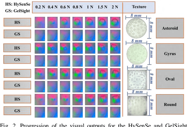 Figure 2 for Pit-Pattern Classification of Colorectal Cancer Polyps Using a Hyper Sensitive Vision-Based Tactile Sensor and Dilated Residual Networks