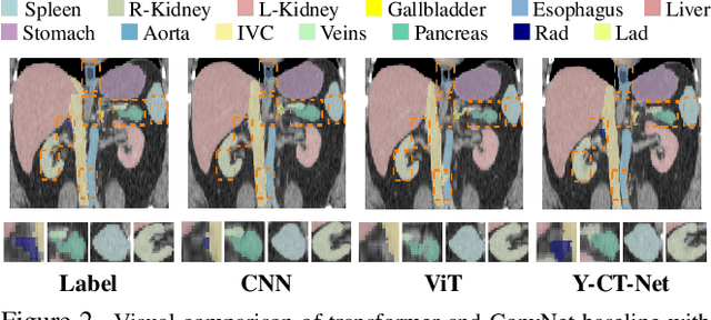 Figure 2 for Y-CA-Net: A Convolutional Attention Based Network for Volumetric Medical Image Segmentation