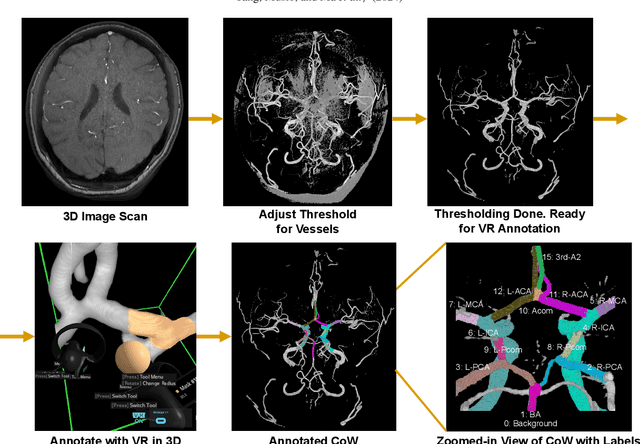 Figure 1 for Benchmarking the CoW with the TopCoW Challenge: Topology-Aware Anatomical Segmentation of the Circle of Willis for CTA and MRA