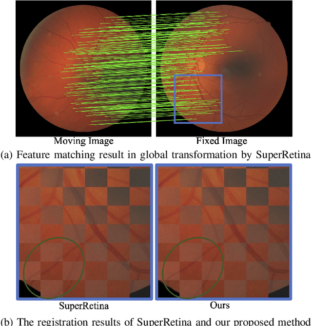 Figure 1 for Progressive Retinal Image Registration via Global and Local Deformable Transformations