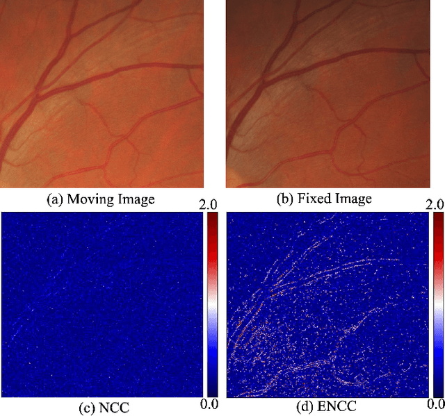 Figure 4 for Progressive Retinal Image Registration via Global and Local Deformable Transformations