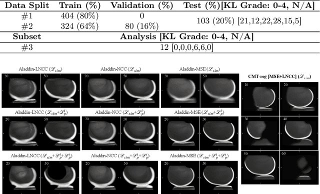 Figure 2 for Quantifying Knee Cartilage Shape and Lesion: From Image to Metrics