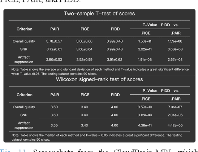 Figure 3 for CloudBrain-ReconAI: An Online Platform for MRI Reconstruction and Image Quality Evaluation