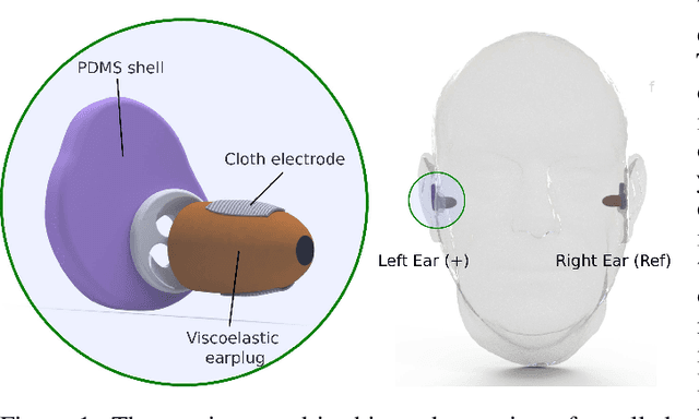 Figure 1 for In-ear ECG Signal Enhancement with Denoising Convolutional Autoencoders