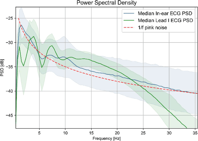 Figure 2 for In-ear ECG Signal Enhancement with Denoising Convolutional Autoencoders