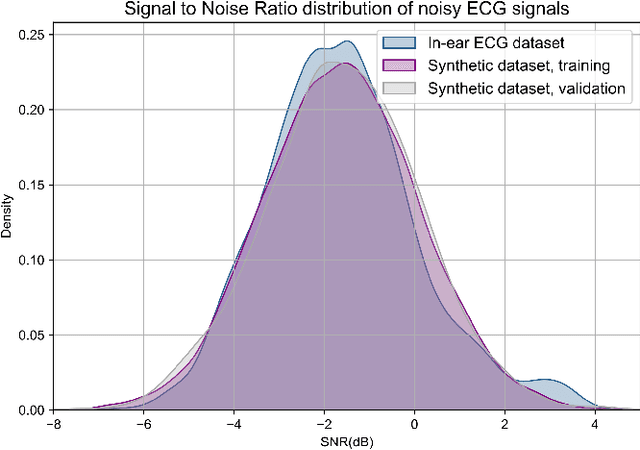 Figure 3 for In-ear ECG Signal Enhancement with Denoising Convolutional Autoencoders