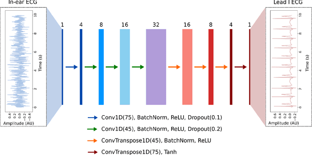 Figure 4 for In-ear ECG Signal Enhancement with Denoising Convolutional Autoencoders