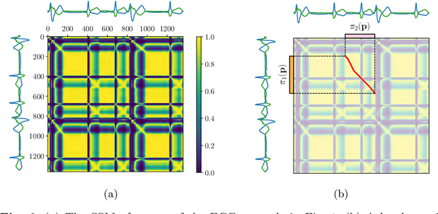 Figure 3 for LoCoMotif: Discovering time-warped motifs in time series