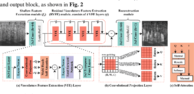 Figure 3 for Deep-Learning-based Vasculature Extraction for Single-Scan Optical Coherence Tomography Angiography