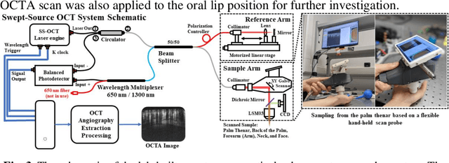 Figure 4 for Deep-Learning-based Vasculature Extraction for Single-Scan Optical Coherence Tomography Angiography