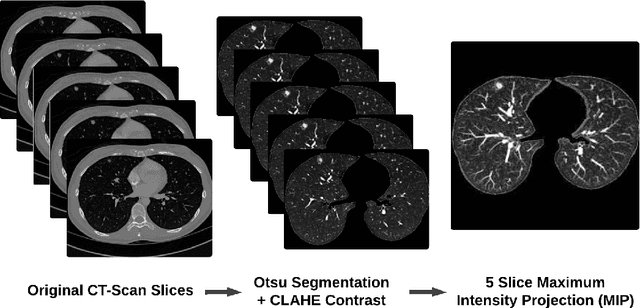 Figure 1 for Lung-DETR: Deformable Detection Transformer for Sparse Lung Nodule Anomaly Detection