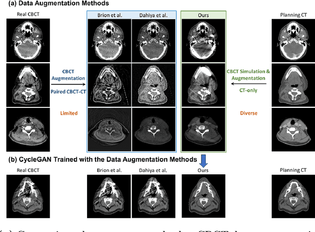 Figure 1 for SinoSynth: A Physics-based Domain Randomization Approach for Generalizable CBCT Image Enhancement